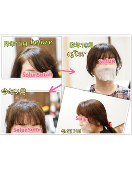 シャイニーソルン 割れる前髪をリセッターで下ろしてキレイを積み重ねています