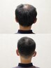 【髪型改善】O字改善カット+眉カット+ボリュームUPホームケア￥11,000→￥7,700