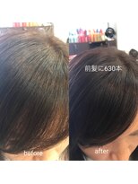 BL ブロッサム 高坂店(BL Blossom)&nbsp;前髪を増やす　東松山市　高坂　ヘアループ　630本