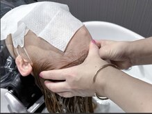 頭皮診断！【赤い方】