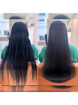 ハナ(HANA) 劇的ビフォーアフター4