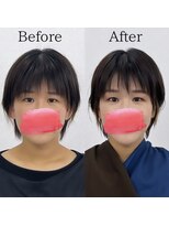 レトア(Letoa)&nbsp;ビフォーアフター