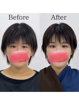 レトア(Letoa) ビフォーアフター