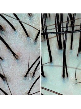 ジール(Zeal)の写真/循環機による新感覚の頭皮ケアで頭皮改善を！潤いと髪質を整え健やかな状態を目指します☆京王堀之内