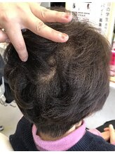 ビューティースポットカルサー 白髪染め グレーカラーで白髪の悩みを解消