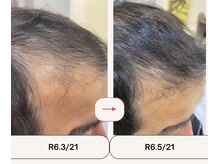 毛髪診断士在籍。髪、頭皮の豊富な実績と確かな知識で、髪と頭皮の悩みをご相談いただけます。