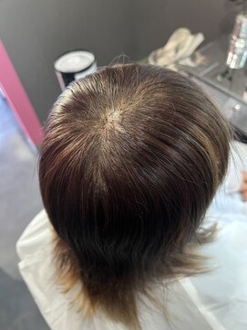 ヴィアンジュ(viange) #ツムケア #気になるトップのお悩みを改善