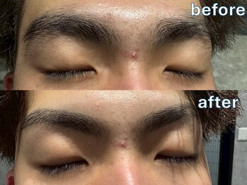 ニューデイズ(NEWDAYS)の写真/経験豊富な技術で、ひげ・眉の身だしなみもお任せ！顔そり・耳の毛剃りで肌もワントーン明るくさっぱり！