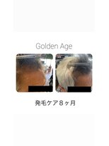 ゴールデンエイジ(Golden Age)&nbsp;【発　毛　ケ　ア　8ヶ月】before & after