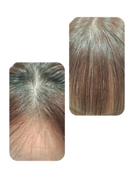 ユーフォルムギンザ(y-Forme Ginza) 話題のトキカタ♪前髪編