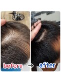 頭皮改善！育毛促進ケア！