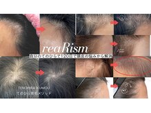 リアリズム(reaRism)の雰囲気（「分け目、地肌の透け見えがつらい」とお悩みの方お任せ下さい）
