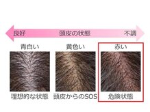なんと！ヘアカラーに含まれる「過酸化水素水」は白髪が増える原因に！