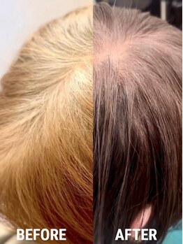 ボタン(botan)の写真/「もう似合う色がわからない…」そんな貴方に。 白髪をただカバーだけしてる日々に飽き飽きしてませんか?