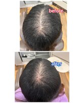 エミ(EMI)&nbsp;エクステンション