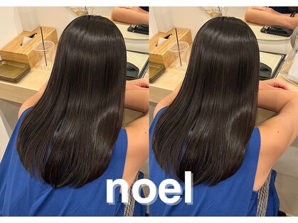 ノエル(NoeL)の写真