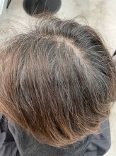 通常の白髪染めのデメリットとは・・・？