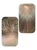 ユーフォルムギンザ(y-Forme Ginza)&nbsp;話題のトキカタ♪前髪編