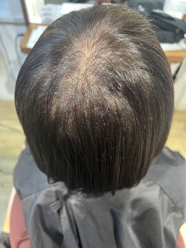 アローズ(arose) 大人エクステビフォーアフター