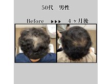 ヘアーアンドアイラッシュラック (Hair＆Eyelash Luck)の雰囲気（育毛促進は2F姉妹店【L＋】へ!http://b.hpr.jp/kr/hp/H000759266）