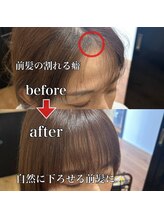 前髪の割れ癖を解消！話題の新技術『クロスパーマ』