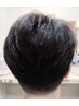 【カッコよく歳を取りたい30代、40代のあなたに】頭皮すっきりコース