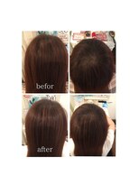 アユーダ(ayuda) ☆生えぐせ分かれ目防止☆