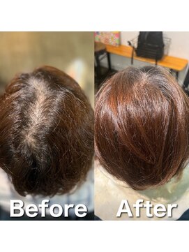 ツムグ 代官山 中目黒(TUMUGU) 地肌見え・つむじ割れ解消/ボリュームアップエクステ