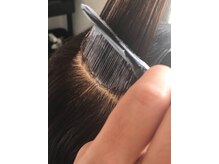シェア(Share)