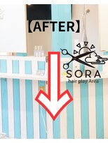 ソラ(SORA)&nbsp;【AFTER】
