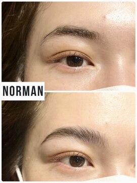 ノーマン(NORMAN) HBL ハリウッドブロウリフト