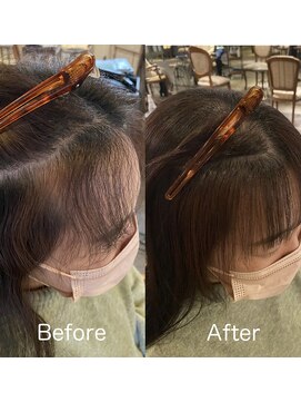 髪質改善と縮毛矯正の専門店 サンティエ(scintiller) 前髪縮毛矯正