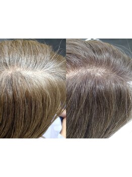 《新時代のグレイカラー》種類豊富なカラー剤でキレイな発色/ハリ/コシ/ツヤ/透明感すべてが叶う◇