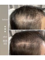 サロン モーリー(salon morley) プロセラセラピーズ 頭皮トリートメント