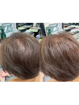 最先端技術のエクステを取り扱いをしています！つけている感覚がないくらい自然な仕上がりを体感ください◎