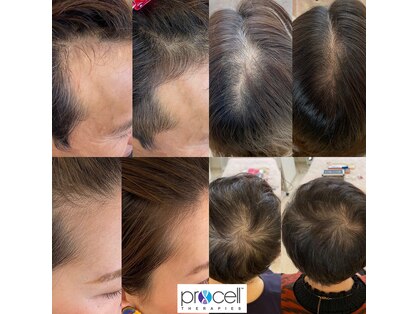 ヘアスペース レフュージエヌ(Hair space Refuge N)の写真