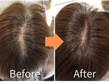 【根本的な改善には継続を】まずは半年～１年続けていきましょう。