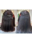 矯正before after