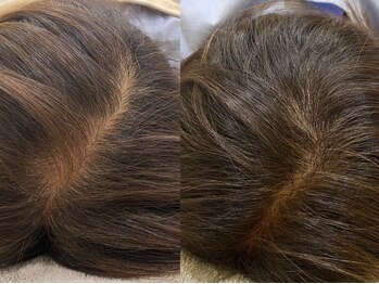 ハリトカミの写真/パサつき,髪のボリュームが気になるあなたに贈る!1人1人に合わせたメニューで頭皮の育毛を促進しましょう♪