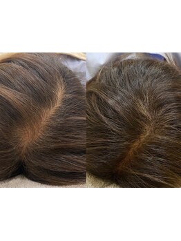 パサつき,髪のボリュームが気になるあなたに贈る!1人1人に合わせたメニューで頭皮の育毛を促進しましょう♪