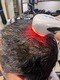美容室 エニシ(Enishi)の写真/年齢に伴う変化にお悩みの方体験必須の【強髪プログラム】ヒト幹細胞培養液を使用し健康な頭皮へ導きます。