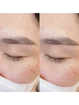 ヘアメイク バンブー(Hair Make Bamboo) メンズ美眉スタイリング