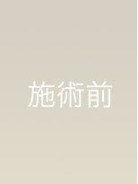 ラディソンカーシィー(RADISSON KASHI)&nbsp;施術前