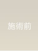 施術前