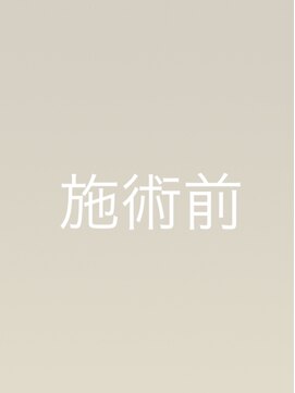 ラディソンカーシィー(RADISSON KASHI) 施術前