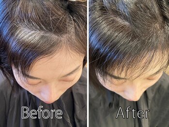 ヘアーサロン ラフリジー(Loufreasy)の写真/ずっと気になっていた“前髪の割れ・つむじパッカリ”を改善！ラフリジー代々木の【TOKIKATA（トキカタ）】