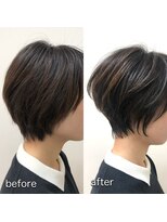 テルミークリニカルデザイン 北千里 ショートくびれショート絶壁解消解消