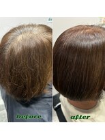 ソイズ ヘアカラーアンドアイラッシュ(SOIS Hair color&Eyelash)&nbsp;オーガニック根元染め＋ヘッドスパ