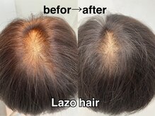 ラソヘアー(Lazo hair)
