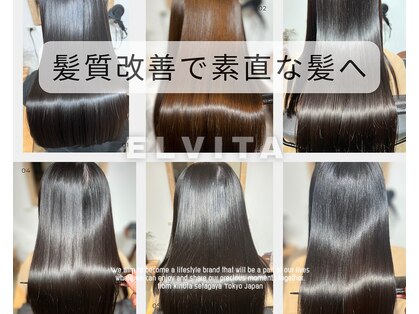 エルヴィタ(ELVITA)の写真